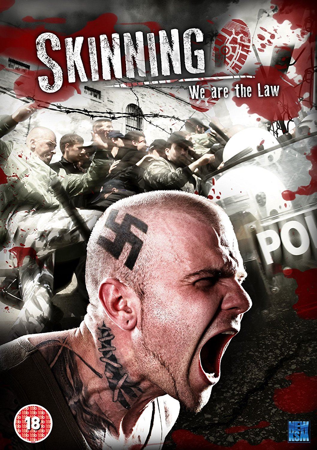 SKINNING-WE ARE THE LAW-DVD
